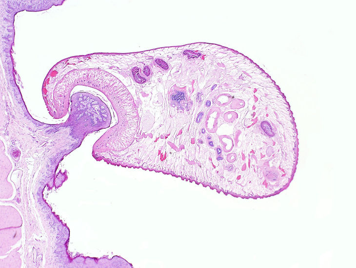 Rumen and Liver Fluke image